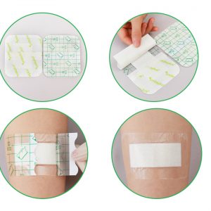 SURGICAL DRESSING